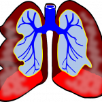 Langzeit Bronchitis