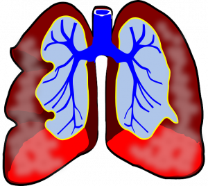 Langzeit Bronchitis